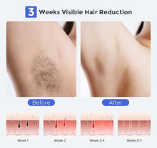 Load image into Gallery viewer, LUBEX Smart Permanent IPL Laser Hair Removal for Woman and Men, Painless Sapphire Ice-Cooling, Alternative to Salon, Bikini Shaver, Facial Epilator for Armpits Back Legs Arms Face Bikini Glow 6 A+
