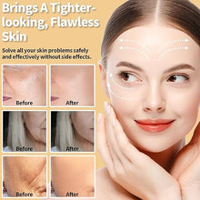 Load image into Gallery viewer, Red Light Therapy for Face - FDA Cleared - UUPAS LED Light Therapy Facial Massager for Face - Skin Tightening Machine for Anti Aging,Wrinkle Removal,Face Lift