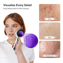 Load image into Gallery viewer, 30x Magnifying Dermatoscope with LED, Rechargeable Handheld Skin Analyzer, 4 Lighting Modes & High Clarity Lens for Skin, Scalp & Hair Follicle Observation