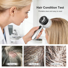 Load image into Gallery viewer, 30x Magnifying Dermatoscope with LED, Rechargeable Handheld Skin Analyzer, 4 Lighting Modes & High Clarity Lens for Skin, Scalp & Hair Follicle Observation