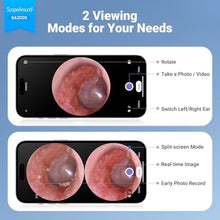 Load image into Gallery viewer, ScopeAround Otoscope with Light, Digital Otoscope w/1.85in IPS Screen, 720p HD Ear Wax Removal Tool Camera, Video Otoscope Ear Camera with 6 LED Lights, Compatible with Android/iPhone