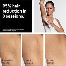Load image into Gallery viewer, Braun IPL, SilkExpert Pro 5, IPL Hair Removal for Women and Men, Permanent Laser Hair Reduction At-Home, 1 Head, IPL5100, White_149