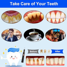 Load image into Gallery viewer, Plaque Remover for Teeth, Tartar Remover for Teeth Cleaning with 4 Replaceable Heads and 3 Adjustable Modes, Rechargeable Teeth Cleaning Plaque Remover for Home, Black_1168