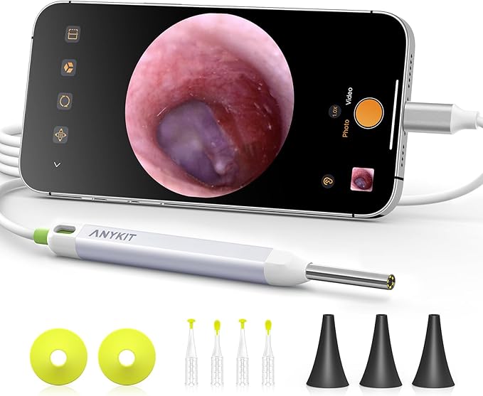 Anykit Digital Otoscope with Gyroscope, HD Ultra Clear View Ear Camera with Ear Wax Removal Tools, Video Ear Scope Otoscope with Light, Compatible with Android, iPhone 15 (White)