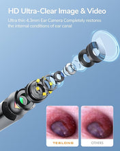 Load image into Gallery viewer, Teslong Digital Otoscope, Ear Camera with Ear Wax Removal Tools, Video Ear Scope Otoscope with Light, Compatible with iPhone15, iPad, Android Phone, USB, Ear Picks, Waterproof, 1080p HD
