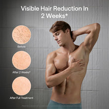 Load image into Gallery viewer, Ulike Laser Hair Removal for Men, Ulike X Plug-in IPL Hair Removal with Ice-Cooling, Dual Lights &amp; Skin Senor for Nearly Painless &amp; Long-Lasting Hair Removal, 3 Modes Tailored for Men’s Stubborn Hair
