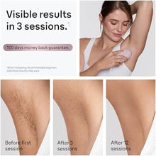 Load image into Gallery viewer, Braun IPL Mini, SilkExpert Mini, IPL Hair Removal for Women and Men, Permanent Laser Hair Reduction At-Home, IPL1111, Pink_2151
