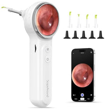 Load image into Gallery viewer, ScopeAround Otoscope with Light, Digital Otoscope w/IPS Screen, 720p HD Ear Wax Removal Tool Camera, Video Otoscope Ear Camera with 6 LED Lights, Compatible with Android/iPhone, White_1
