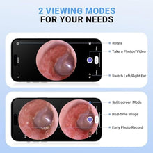 Load image into Gallery viewer, ScopeAround Otoscope with Light, Digital Otoscope w/IPS Screen, 720p HD Ear Wax Removal Tool Camera, Video Otoscope Ear Camera with 6 LED Lights, Compatible with Android/iPhone, White_4000
