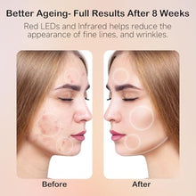 Load image into Gallery viewer, YKeluxon Face Mask Light Therapy, LED Red Light Therapy for Face, Infrared &amp; Red Light Therapy for Face, 6000mAh Rechargeable Portable Redlight Facial Device for Home Use, Gold_440
